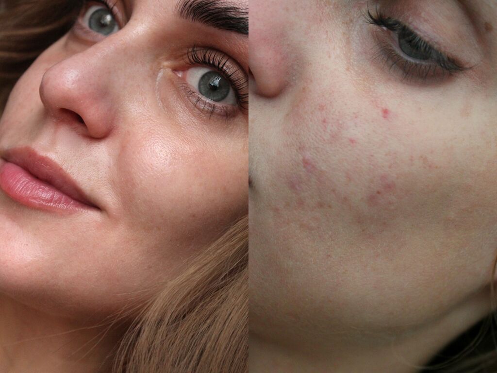 Зволожуючий крем З АНА І ВНА Кислотами A"pieu Glycolic Acid Cream - Зображення 2