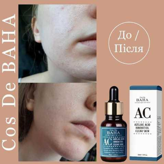 Сироватка для боротьби з акне Cos de Baha AC Azelaic Acid Hinokitiol Clear Skin Serum 30ml - Зображення 2